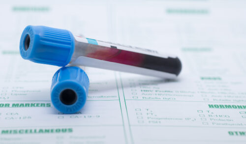 Valori ottimali colesterolo