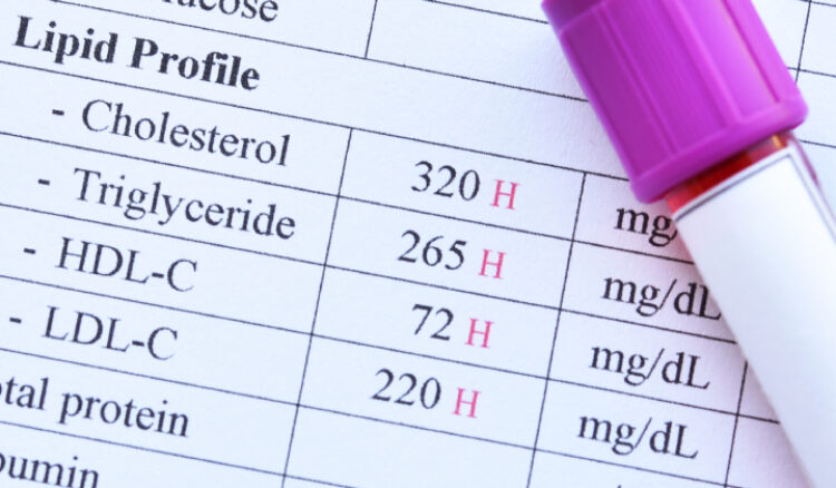 Ipercolesterolemia
