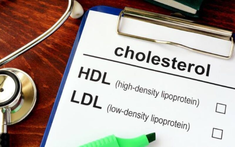 Rapporto colesterolo hdl ldl